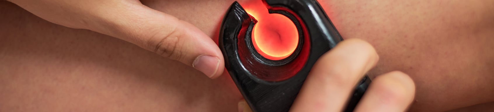 Amulet Capital Partners Acquires United Vein & Vascular Centers